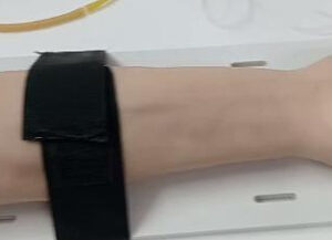 IV ARM WITH ACRYLIC SILICON